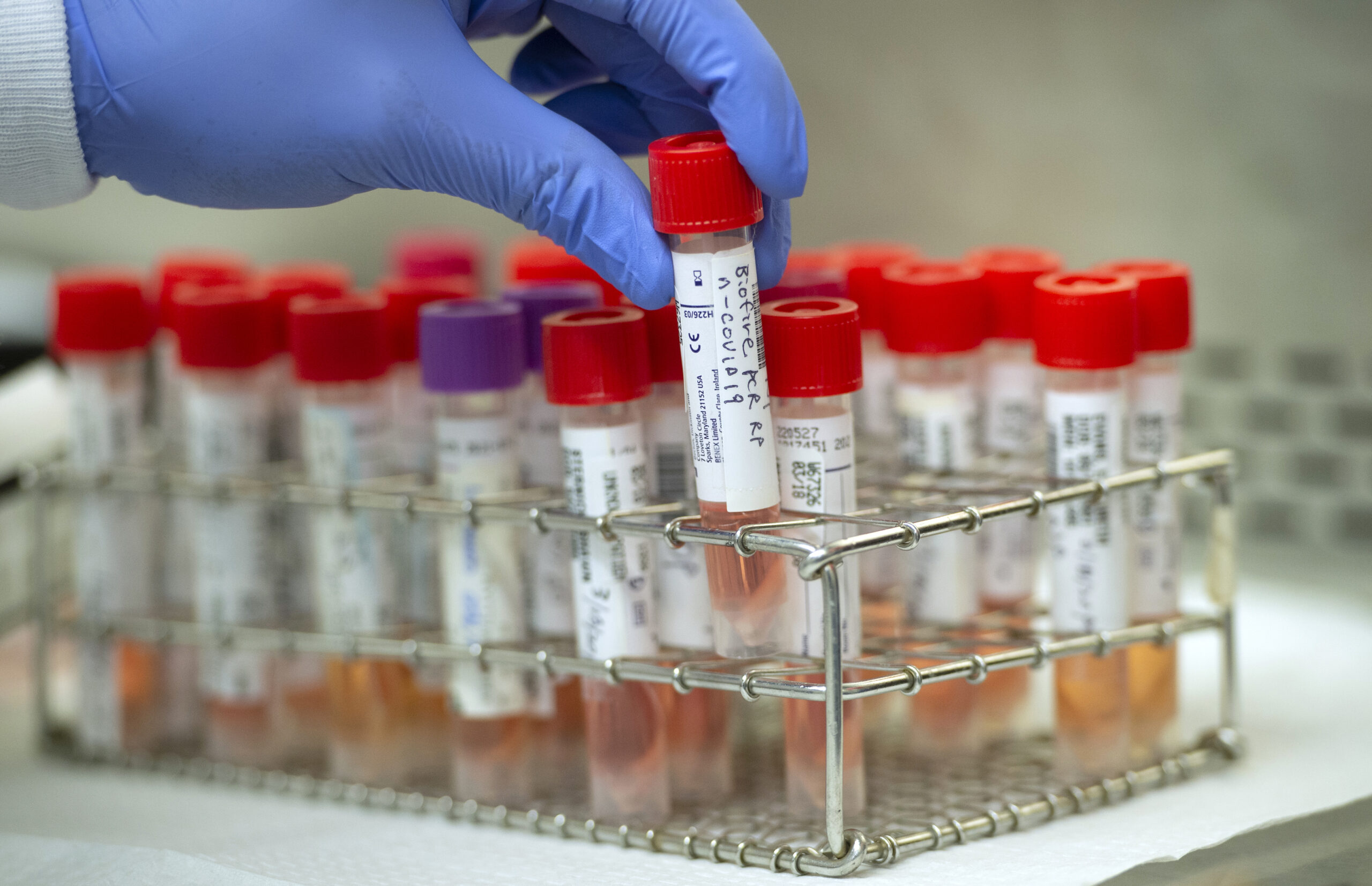 Coronavirus test tubes